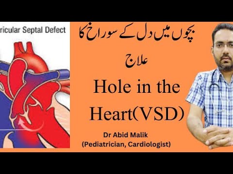 Hole in the Heart (VSD) — Dil Ma Sorakh (Urdu)