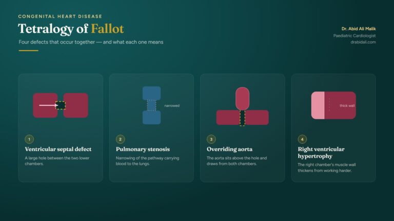 Tetralogy of Fallot (TOF): Understanding the Blue Baby Heart Condition