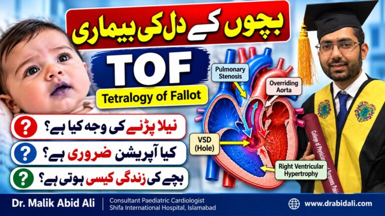 بچوں کے دل کی پیدائشی بیماری ٹیٹرالوجی آف فیلو (TOF): علامات، نیلا پڑنا اور علاج